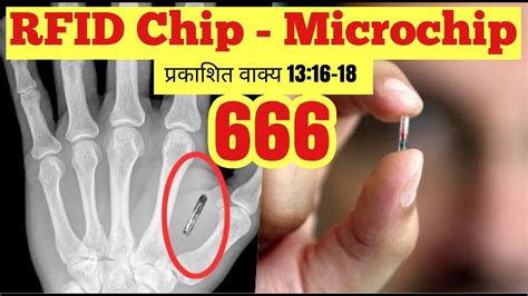 what is rfid chip 666|microchip patent 666.